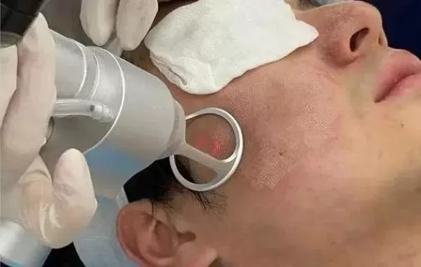 4级激光危害解析：眼部、皮肤损伤及安全防护措施